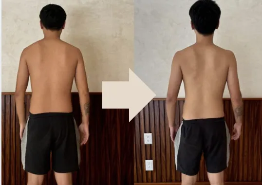 Member posture transformation, back view before and after