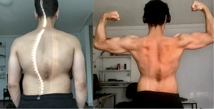Member posture transformation, back view showing spine before and after